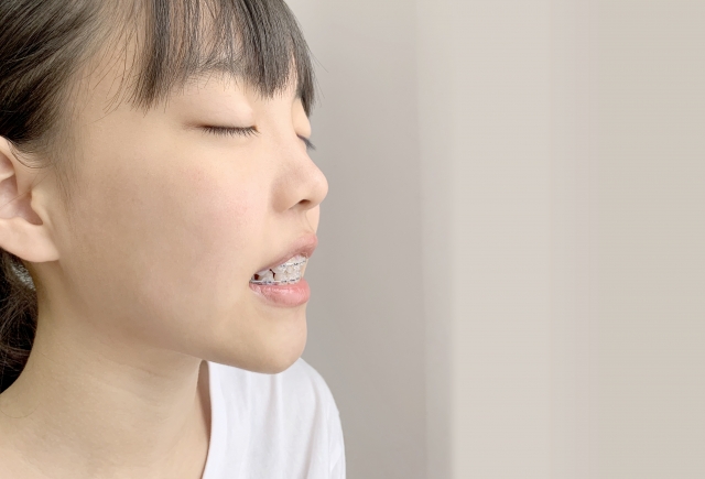 子供の矯正治療後の後戻り対策|長期的な成果を保つためのポイント