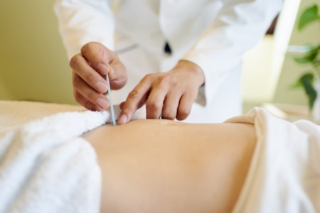 ダイエット鍼の効果と施術方法｜健康的に体重を減らす新しいアプローチ