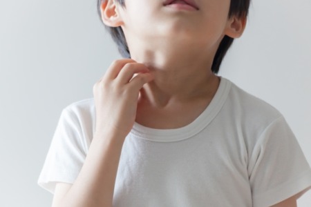 子どもの蕁麻疹：原因、症状、そして治療法