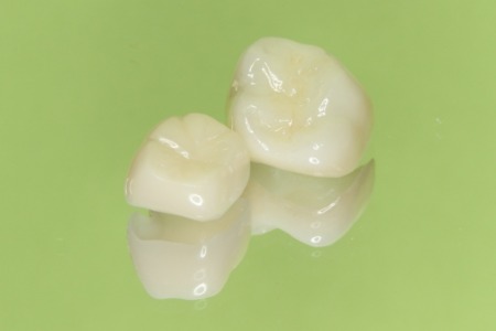 セラミック治療の「ジルコニア」の特徴とそのメリット・デメリット