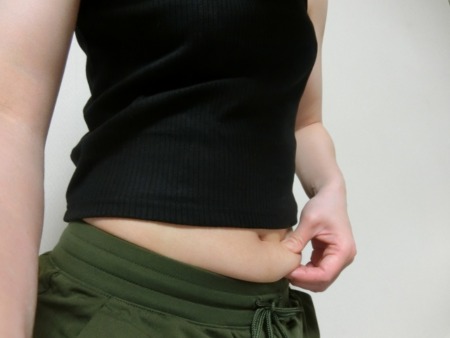 脂肪吸引の特徴と注意点｜選ぶ前に知っておきたいポイント