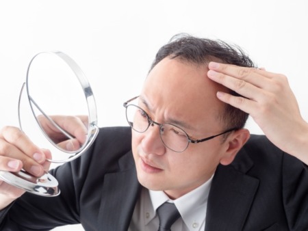 AGAは放置で進行するのはご存知ですか？進行を防ぐためのポイント