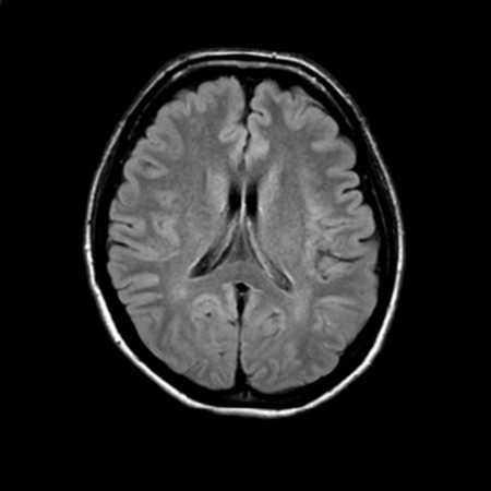 脳ドックは何歳から受けるべき？その必要性と受診のタイミング